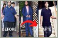 Anant Ambani's Journey: Battling A Rare Disease With Courage
